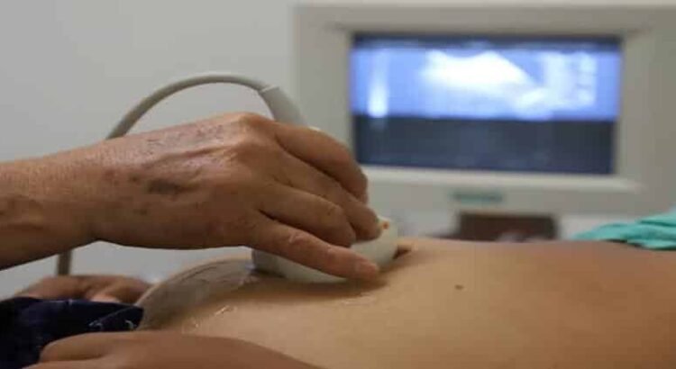 Disminuyeron 36.6% las muertes maternas en Michoacán en últimos cuatro años